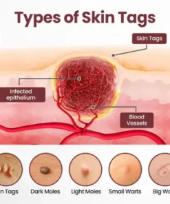 Croaie® KeraErase RICEDUAL-ACTION RENEWAL CREAM