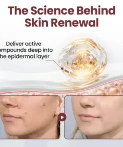 Croaie® KeraErase RICEDUAL-ACTION RENEWAL CREAM