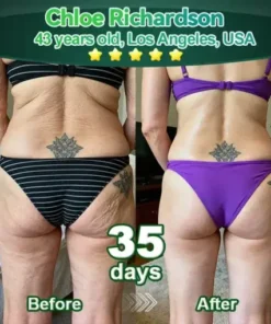 Cvreoz® 𝑆𝑡𝑒𝑚 𝐶𝑒𝑙𝑙 & 𝐶𝑜𝑙𝑙𝑎𝑔𝑒𝑛 𝑃𝑒𝑝𝑡𝑖𝑑𝑒 𝑂𝑟𝑎𝑙 𝐷𝑟𝑜𝑝𝑠