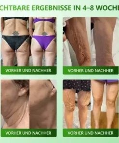 Cvreoz® 𝗬𝗼𝘂𝐭𝐡𝐆𝗹𝗼𝘄 𝑺𝒕𝙖𝙢𝙢𝙯𝙚𝒍𝒍𝒆𝒏 𝙆𝙤𝒍𝒍𝒂𝙜𝙚𝒏 𝗧𝗿𝗼𝒑𝐟𝙚𝙣