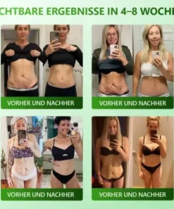 Cvreoz® 𝗬𝗼𝘂𝐭𝐡𝐆𝗹𝗼𝘄 𝑺𝒕𝙖𝙢𝙢𝙯𝙚𝒍𝒍𝒆𝒏 𝙆𝙤𝒍𝒍𝒂𝙜𝙚𝒏 𝗧𝗿𝗼𝒑𝐟𝙚𝙣