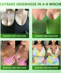 Cvreoz® 𝗬𝗼𝘂𝐭𝐡𝐆𝗹𝗼𝘄 𝑺𝒕𝙖𝙢𝙢𝙯𝙚𝒍𝒍𝒆𝒏 𝙆𝙤𝒍𝒍𝒂𝙜𝙚𝒏 𝗧𝗿𝗼𝒑𝐟𝙚𝙣