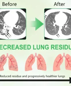 GFOUK® 3X Concentrated Mullein Lung Cleanse Drops