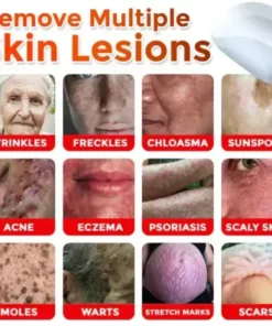 Juxek™ Removal Patch: Gentle Microneedle Patches for Skin Tag & Mole Removal