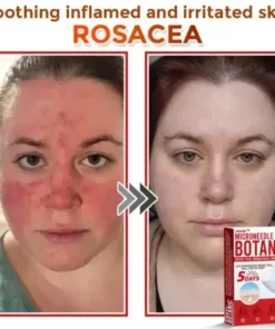 Juxek™ Removal Patch: Gentle Microneedle Patches for Skin Tag & Mole Removal