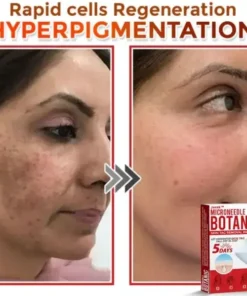 Juxek™ Removal Patch: Gentle Microneedle Patches for Skin Tag & Mole Removal