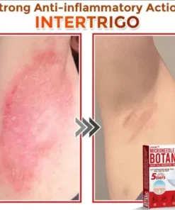 Juxek™ Removal Patch: Gentle Microneedle Patches for Skin Tag & Mole Removal