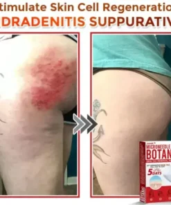 Juxek™ Removal Patch: Gentle Microneedle Patches for Skin Tag & Mole Removal