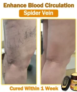 LOVILDS™ 𝐁𝐞𝐞 Poison 𝐀𝐥𝐥-𝐢𝐧-𝐎𝐧𝐞 𝐂𝐫𝐞𝐚𝐦