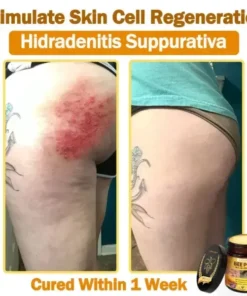 LOVILDS™ 𝐁𝐞𝐞 Poison 𝐀𝐥𝐥-𝐢𝐧-𝐎𝐧𝐞 𝐂𝐫𝐞𝐚𝐦