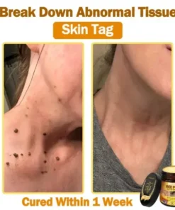 LOVILDS™ 𝐁𝐞𝐞 Poison 𝐀𝐥𝐥-𝐢𝐧-𝐎𝐧𝐞 𝐂𝐫𝐞𝐚𝐦