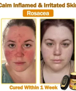 LOVILDS™ 𝐁𝐞𝐞 Poison 𝐀𝐥𝐥-𝐢𝐧-𝐎𝐧𝐞 𝐂𝐫𝐞𝐚𝐦