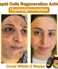 LOVILDS™ 𝐁𝐞𝐞 Poison 𝐀𝐥𝐥-𝐢𝐧-𝐎𝐧𝐞 𝐂𝐫𝐞𝐚𝐦