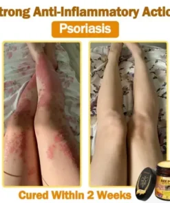 LOVILDS™ 𝐁𝐞𝐞 Poison 𝐀𝐥𝐥-𝐢𝐧-𝐎𝐧𝐞 𝐂𝐫𝐞𝐚𝐦