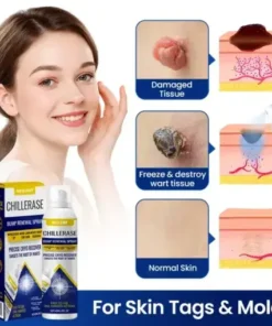 NESLEMY® ChillErase Bump Renewal Spray