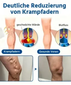 Oveallgo® 𝐕𝐞𝐢𝐧𝐓𝐚𝐫𝐠𝐞𝐭 𝐌𝐢𝐜𝐫𝐨𝐧𝐞𝐞𝐝𝐥𝐞 𝐏𝐚𝐭𝐜𝐡