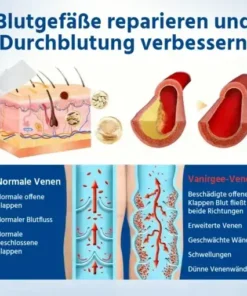 Oveallgo® 𝐕𝐞𝐢𝐧𝐓𝐚𝐫𝐠𝐞𝐭 𝐌𝐢𝐜𝐫𝐨𝐧𝐞𝐞𝐝𝐥𝐞 𝐏𝐚𝐭𝐜𝐡