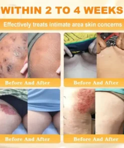 Rolimey® Bee Venom Skin Restoration Cream