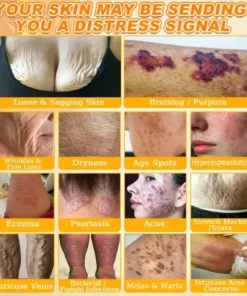 Rolimey® Bee Venom Skin Restoration Cream