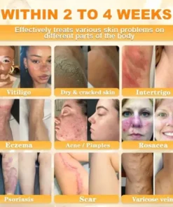 Rolimey® Bee Venom Skin Restoration Cream