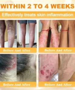 Rolimey® Bee Venom Skin Restoration Cream