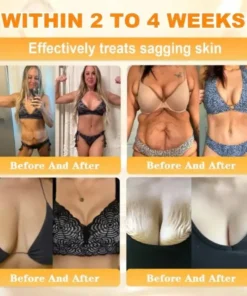 Rolimey® Bee Venom Skin Restoration Cream