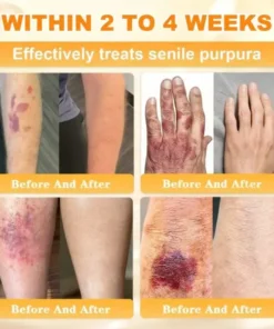 Rolimey® Bee Venom Skin Restoration Cream