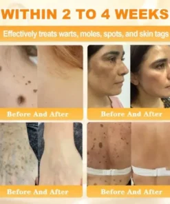 Rolimey® Bee Venom Skin Restoration Cream