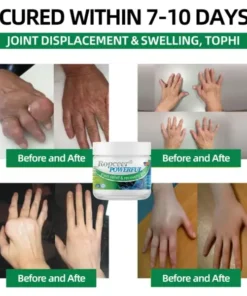 Ropceer® Powerful pain relief& recovery gel