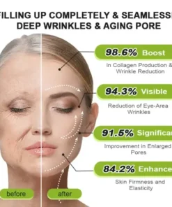 Rolimey® Botox & Vita-A Retinol Shot Tightening and Wrinkle-Reducing Cream
