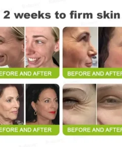 Rolimey® Botox & Vita-A Retinol Shot Tightening and Wrinkle-Reducing Cream