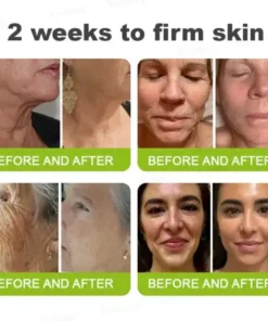 Rolimey® Botox & Vita-A Retinol Shot Tightening and Wrinkle-Reducing Cream