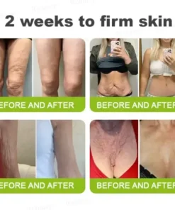 Rolimey® Botox & Vita-A Retinol Shot Tightening and Wrinkle-Reducing Cream